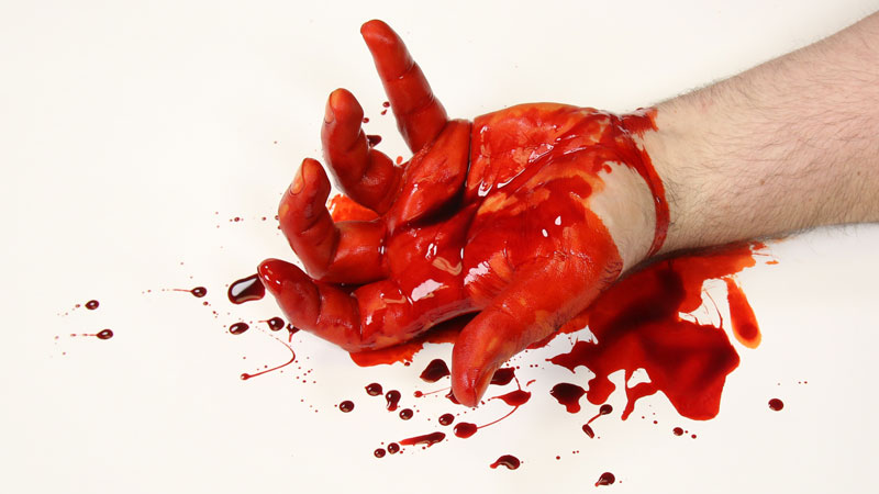 Ultimate Blood Kit Image: