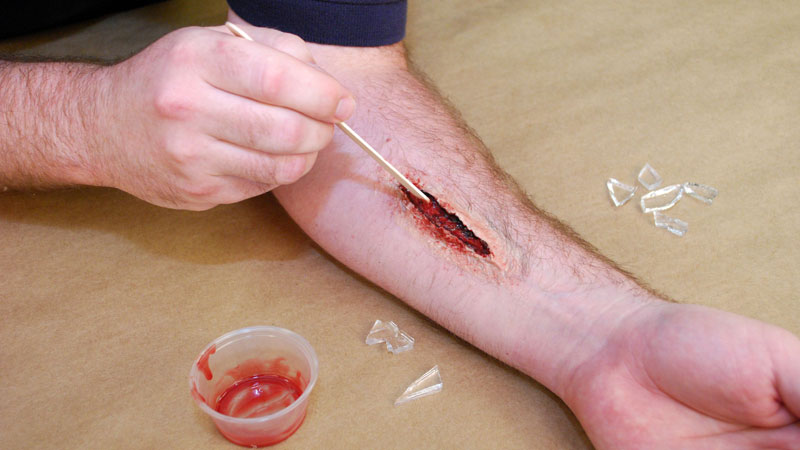 Ultimate Wound Kit Image: