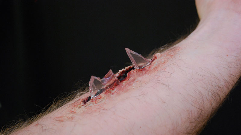 Ultimate Wound Kit Image: