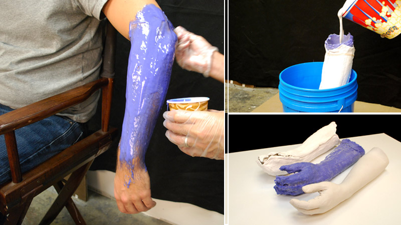 Orthotics & Prosthetics Image: