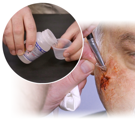 Derma-tac Remover